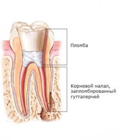 Коронка по дереву, как пользоваться. Сфера применения инструмента 08 Коронка по дереву, как пользоваться. Сфера применения инструмента 08